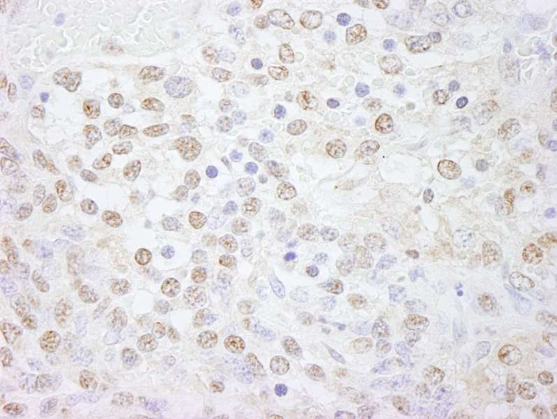 Detection of Mouse Pol Lambda by Immunohistochemistry. Sample: FFPE section of mouse teratoma. Antibody: Affinity purified rabbit anti-Pol Lambda used at a dilution of 1:250.