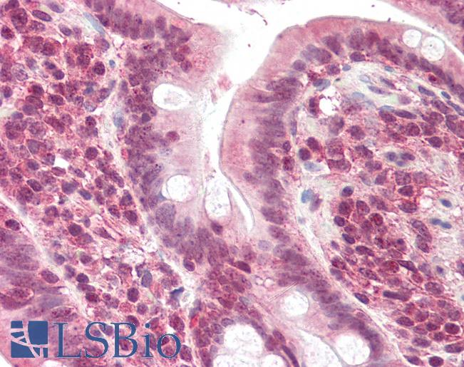 Anti-POLL antibody IHC of human small intestine. Immunohistochemistry of formalin-fixed, paraffin-embedded tissue after heat-induced antigen retrieval. Antibody LS-B2284 concentration 5 ug/ml.