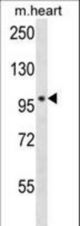 POLN Antibody western blot of mouse heart tissue lysates (35 ug/lane). The POLN antibody detected the POLN protein (arrow).