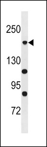 POLR1A Antibody western blot of A375 cell line lysates (35 ug/lane). The POLR1A antibody detected the POLR1A protein (arrow).