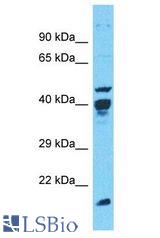 POLR1C / RPA39 antibody Western Blot of Jurkat. Antibody dilution: 1 ug/ml.
