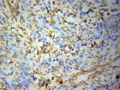 Immunohistochemistry (IHC) analysis of POLR1C pAb in paraffin-embedded H-spleen tissue.