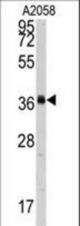 Western blot of anti-POLR1C Antibody in A2058 cell line lysates (35 ug/lane). POLR1C (arrow) was detected using the purified antibody.