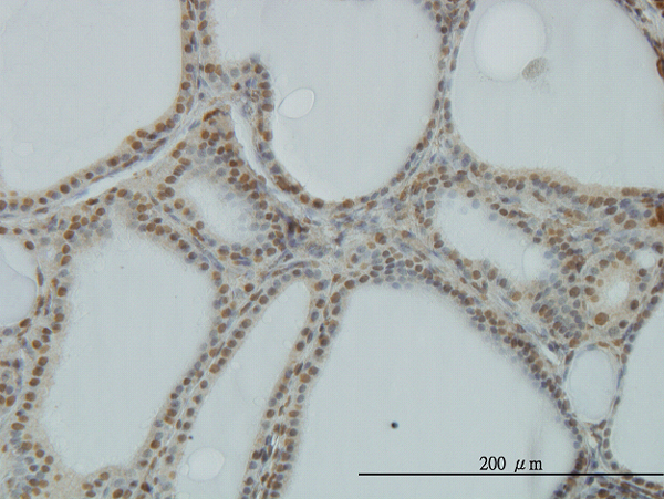Immunoperoxidase of monoclonal antibody to POLR1C on formalin-fixed paraffin-embedded human thyroid nodular goiter. [antibody concentration 3 ug/ml]