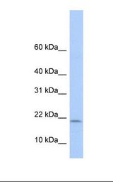 Fetal lung lysate. Antibody concentration: 1.0 ug/ml. Gel concentration: 10-20%.