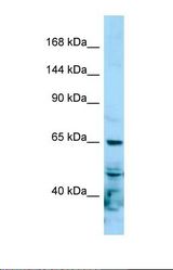 Western blot of Human Hela. POLR2A antibody dilution 1.0 ug/ml.