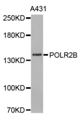 Western blot analysis of extracts of A431 cell line, using POLR2B antibody.