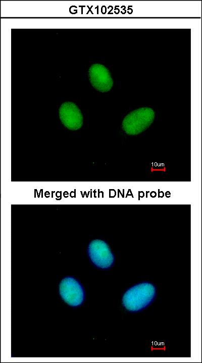 Immunofluorescence of paraformaldehyde-fixed HeLa using POLR2B antibody at 1:200 dilution.