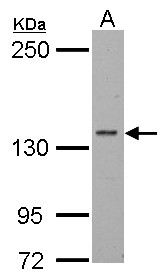 Sample (30 ug of whole cell lysate). A: BCL-1. 5% SDS PAGE. POLR2B / RPB2 antibody diluted at 1:1000.