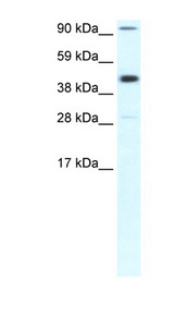 POLR2B / RPB2 antibody LS-B1557 Western blot of Fetal Muscle lysate.
