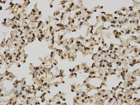 Immunohistochemistry of paraffin-embedded mouse lung using POLR2C antibody at dilution of 1:100 (400x lens).