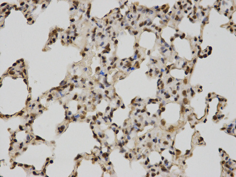 Immunohistochemistry of paraffin-embedded rat lung using POLR2C antibody at dilution of 1:100 (400x lens).