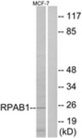 Western blot of extracts from MCF-7 cells, using RPAB1 Antibody. The lane on the right is treated with the synthesized peptide.