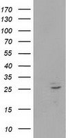 HEK293T cells were transfected with the pCMV6-ENTRY control (Left lane) or pCMV6-ENTRY POLR2E (Right lane) cDNA for 48 hrs and lysed. Equivalent amounts of cell lysates (5 ug per lane) were separated by SDS-PAGE and immunoblotted with anti-POLR2E.