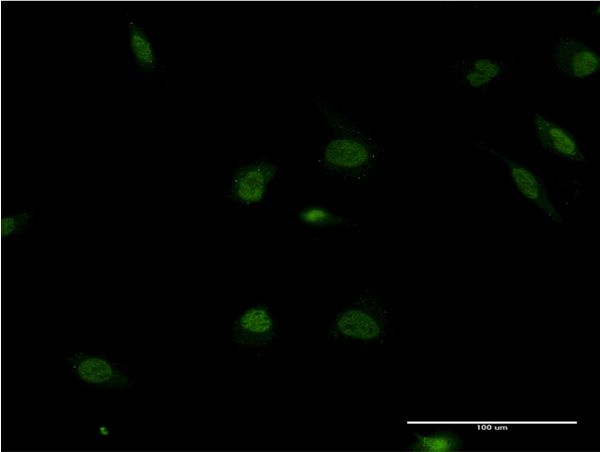 Immunofluorescence of monoclonal antibody to POLR2F on HeLa cell . [antibody concentration 10 ug/ml]