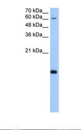 HepG2 cell lysate. Antibody concentration: 5.0 ug/ml. Gel concentration: 15%.