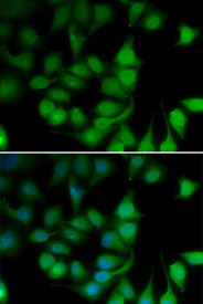 Immunofluorescence blot of U20S cell using POLR2H antibody. Blue: DAPI for nuclear staining.