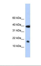Placenta lysate. Antibody concentration: 1.0 ug/ml. Gel concentration: 10%-20%.