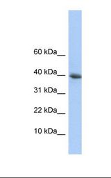 HepG2 cell lysate. Antibody concentration: 1.0 ug/ml. Gel concentration: 10-20%.