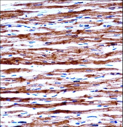 POLR2J Antibody immunohistochemistry of formalin-fixed and paraffin-embedded human heart tissue followed by peroxidase-conjugated secondary antibody and DAB staining.