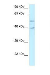 GRINL1A antibody LS-C145739 Western blot of Placenta lysate. Antibody concentration 1 ug/ml.