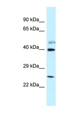 GRINL1A antibody LS-C145740 Western blot of Fetal Lung lysate. Antibody concentration 1 ug/ml.