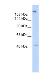POLR3A antibody LS-C111186 Western blot of Fetal Muscle lysate.