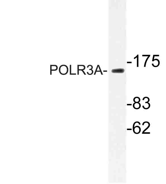 Western blot of POLR3A (P68) pAb in extracts from HUVEC cells.