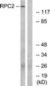 Western blot of extracts from LOVO cells, using RPC2 Antibody. The lane on the right is treated with the synthesized peptide.