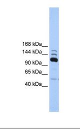 Fetal heart lysate. Antibody concentration: 1.0 ug/ml. Gel concentration: 6%-18%.