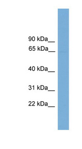 POLR3C antibody LS-C117179 Western blot of 293T cell lysate.