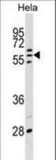 POLR3C Antibody western blot of HeLa cell line lysates (35 ug/lane). The POLR3C antibody detected the POLR3C protein (arrow).