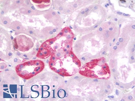 Human Kidney: Formalin-Fixed, Paraffin-Embedded (FFPE)