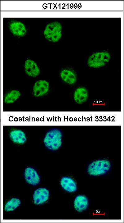 Immunofluorescence of paraformaldehyde-fixed A431, using POLR3E antibody at 1:500 dilution.