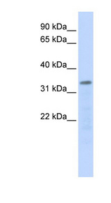 POLR3F antibody LS-C102315 Western blot of 721_B cell lysate.