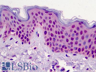 Anti-POLR3F antibody IHC of human skin. Immunohistochemistry of formalin-fixed, paraffin-embedded tissue after heat-induced antigen retrieval. Antibody LS-B4985 concentration 5 ug/ml.
