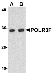 Western blot of POLR3F in human brain tissue lysate with POLR3F antibody at (A) 0.5 and (B) 1 ug/ml.