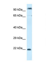 POLR3GL antibody LS-C145456 Western blot of MCF7 Cell lysate. Antibody concentration 1 ug/ml.