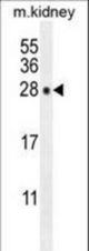 POLR3GL Antibody western blot of mouse kidney tissue lysates (35 ug/lane). The POLR3GL antibody detected the POLR3GL protein (arrow).