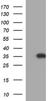 HEK293T cells were transfected with the pCMV6-ENTRY control (Left lane) or pCMV6-ENTRY POLR3GL (Right lane) cDNA for 48 hrs and lysed. Equivalent amounts of cell lysates (5 ug per lane) were separated by SDS-PAGE and immunoblotted with anti-POLR3GL.