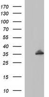 HEK293T cells were transfected with the pCMV6-ENTRY control (Left lane) or pCMV6-ENTRY POLR3GL (Right lane) cDNA for 48 hrs and lysed. Equivalent amounts of cell lysates (5 ug per lane) were separated by SDS-PAGE and immunoblotted with anti-POLR3GL.