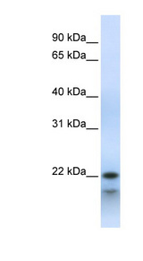POLR3H antibody LS-C111181 Western blot of Fetal Muscle lysate.