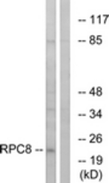 Western blot of extracts from K562 cells, using RPC8 Antibody. The lane on the right is treated with the synthesized peptide.