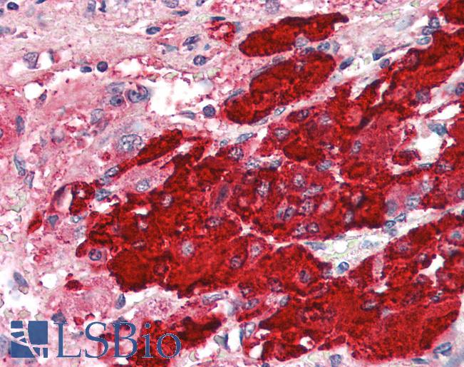 Anti-POMC antibody IHC of human adrenal. Immunohistochemistry of formalin-fixed, paraffin-embedded tissue after heat-induced antigen retrieval. Antibody LS-B2391 concentration 5 ug/ml.