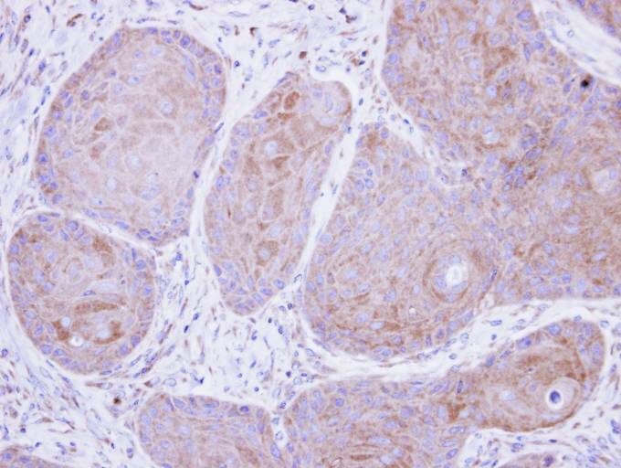 IHC of paraffin-embedded Cal27 xenograft using POMGNT1 antibody at 1:500 dilution.