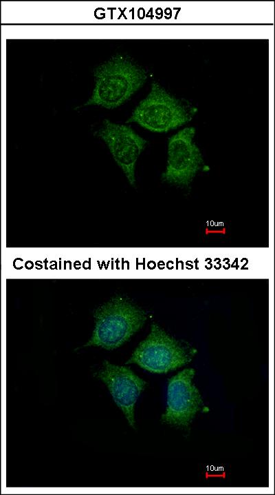 Immunofluorescence of methanol-fixed Hep3B using POMGNT1 antibody at 1:500 dilution.