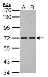 Sample (30 ug of whole cell lysate). A: Hela, B: Hep G2 . 7.5% SDS PAGE. POMGNT1 antibody diluted at 1:1000.