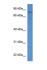 POMGNT1 antibody LS-C135217 Western blot of Mouse Brain lysate. Antibody concentration 1 ug/ml.