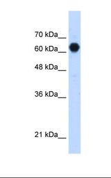 HepG2 cell lysate. Antibody concentration: 1.25 ug/ml. Gel concentration: 12%.