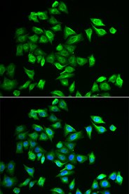Immunofluorescence analysis of A549 cell using GTDC2 antibody. Blue: DAPI for nuclear staining.